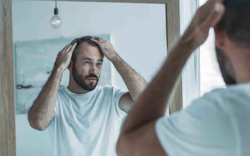 perte de cheveux