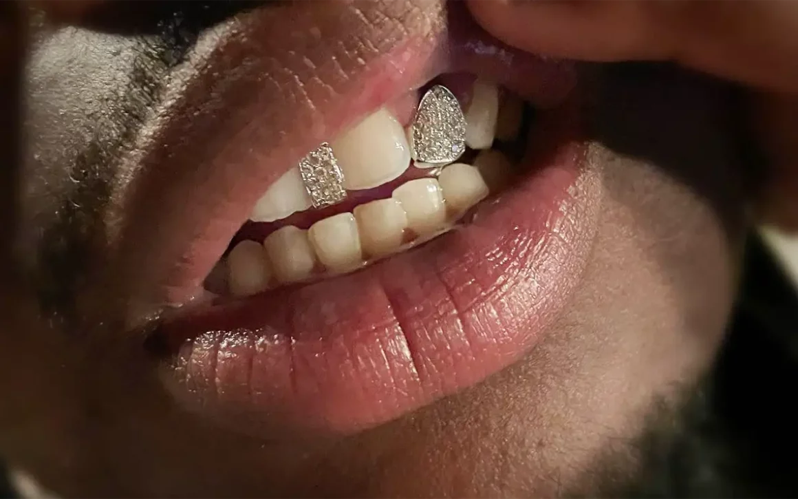 Le grillz trendy diamants