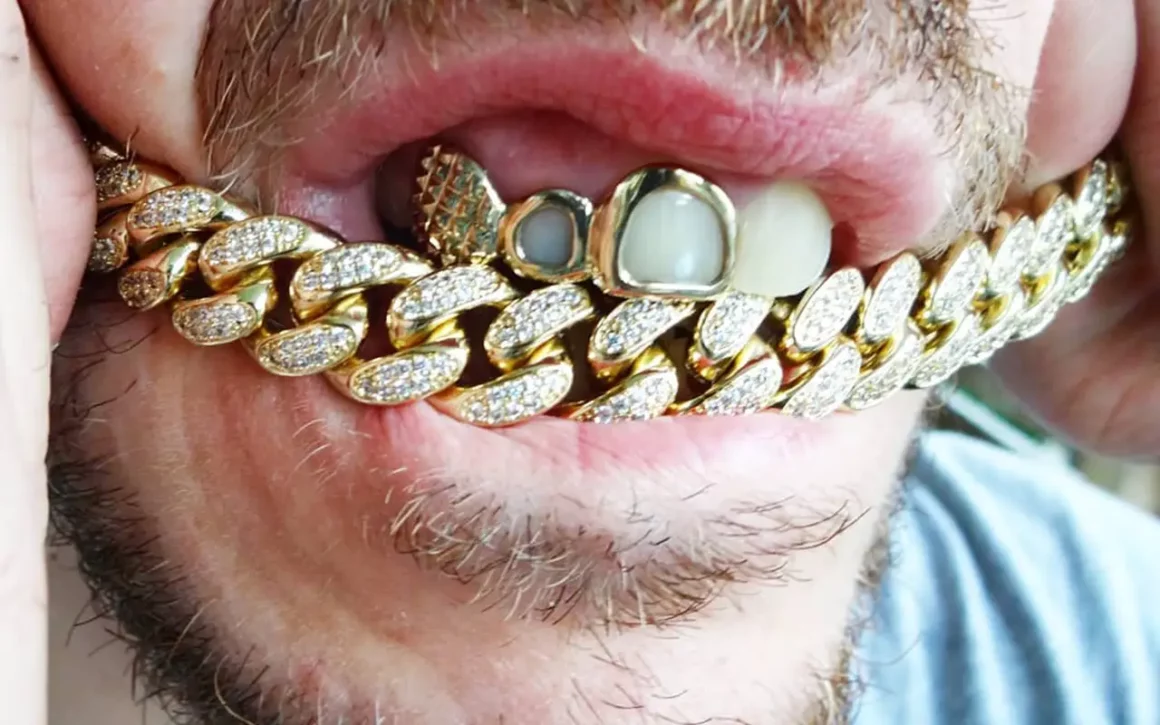 Le grillz trendy doré