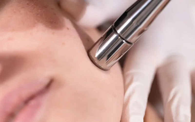 teint eclatant microdermabrasion