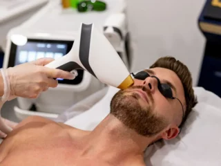 Le laser contre la barbe clairsemée institut