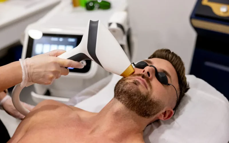 Le laser contre la barbe clairsemée institut